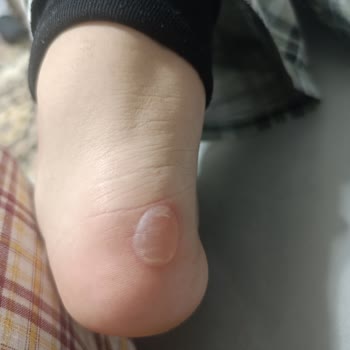 FLO Mağazasından Aldığım Ayakkabı İlk Kullanımda Ciddi Sorun Yaşattı, Çözüm Sunulmadı