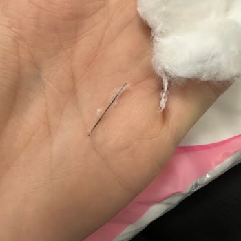 Lure Hidrofil Pamuk İçinden Yabancı Cisim Çıkması Nedeniyle Güvenlik Ve Hijyen Endişesi
