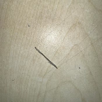 Lure Hidrofil Pamuk İçinden Yabancı Cisim Çıkması Nedeniyle Güvenlik Ve Hijyen Endişesi