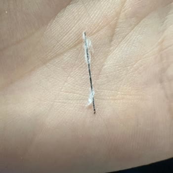 Lure Hidrofil Pamuk İçinden Yabancı Cisim Çıkması Nedeniyle Güvenlik Ve Hijyen Endişesi