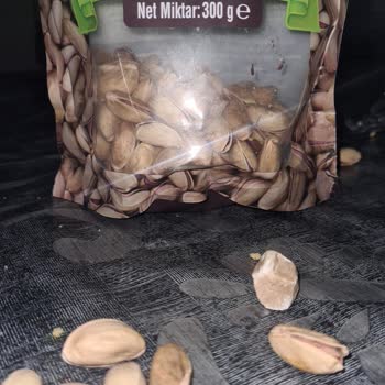 Çerezya Aldığım Antep Fıstığının İçinden Taş Çıktı Dişim Ağrıdı Ve Güvenim Sarsıldı