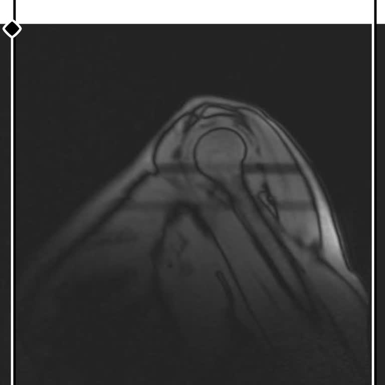 MR Raporunun Gecikmesi Tedavimi Aksatıyor Ve Sağlık Durumumu Olumsuz Etkiliyor