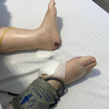 Baypark Hospital Bayrampaşa Yoğun Bakımda Ciddi İhmal Ve Bilgilendirme Eksikliği