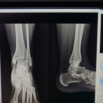 Acil Serviste İlgisizlik Ve Laubali Davranışlar Nedeniyle Mağduriyet Yaşadım