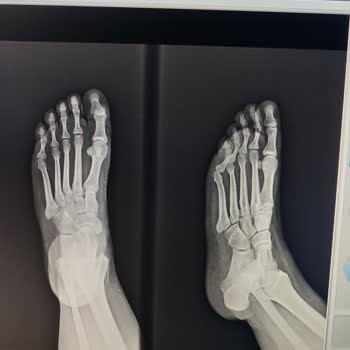 Acil Serviste İlgisizlik Ve Laubali Davranışlar Nedeniyle Mağduriyet Yaşadım