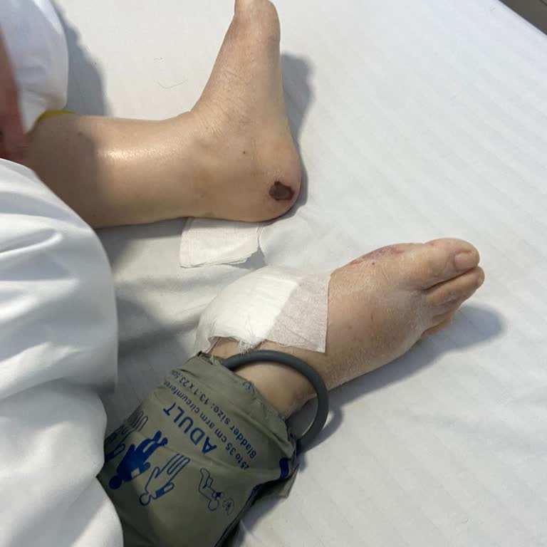 Baypark Hospital Bayrampaşa Yoğun Bakımda Anneme Yapılan İhmal