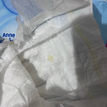 Yenidoğan Bebek Bezinde Hijyen Sorunu Ve Güven Kaybı Yaşadım