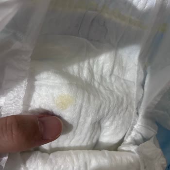 Yenidoğan Bebek Bezinde Hijyen Sorunu Ve Güven Kaybı Yaşadım