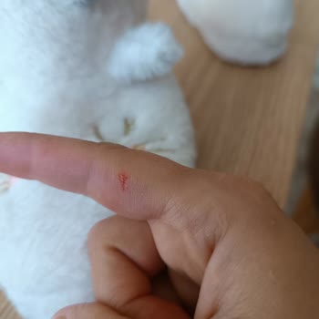 Ürün Üzerindeki Alarm Nedeniyle Yaralanma Ve Mağaza Personelinin Dikkatsizliği