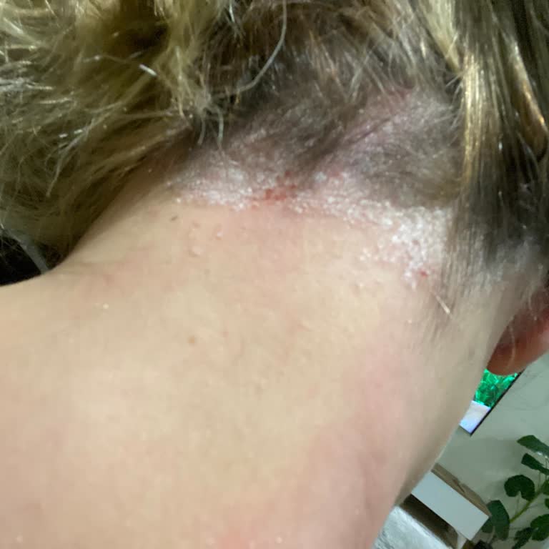 Markaya Güvenerek Aldığım Şampuan Saç Derimde Sorunları Artırdı Ve Satıcı Değişikliğiyle Hayal Kırıklığı Yaşadım