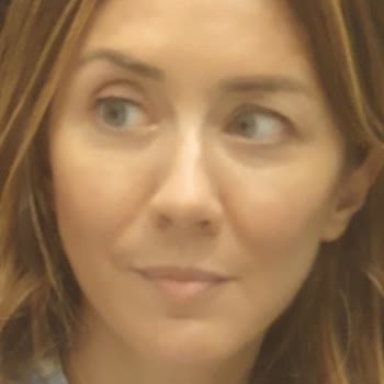 Yüzümde Yapılan İşlem Sonrası Doğal Hatlarım Bozuldu Ve İfadem Sağlıksız Görünüyor