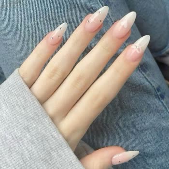 Dilan Oğuz Nail Salon Protez İşlem Memnuniyetsizliği