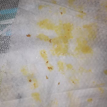 Kapalı Ambalajdan Canlı Kurt Çıkan Noodle: Sağlık Ve Güven Sorunu