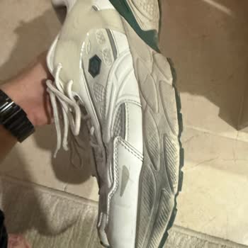 Ayakkabıda Hızlı Renk Solması Ve Yetersiz Müşteri Desteği