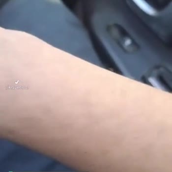 Braun Lazer Makinesi Hüsranı!