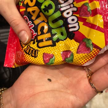 Kent Jelibonun İçinden Taş Çıktı, Dişim Kırıldı