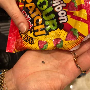 Kent Jelibonun İçinden Taş Çıktı, Dişim Kırıldı