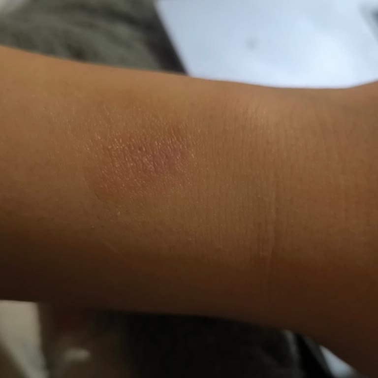 Xiaomi Redmi Watch 5 Active Kolumda Tahrişe Ve Kötü Kokuya Neden Oldu