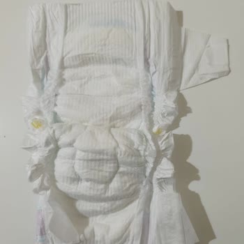 Kusurlu Molfix Bebek Bezi Ve Yetersiz Müşteri Desteği Nedeniyle Mağduriyet