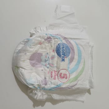 Kusurlu Molfix Bebek Bezi Ve Yetersiz Müşteri Desteği Nedeniyle Mağduriyet