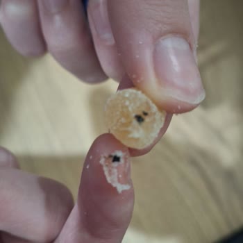 Jelibon Paketinden Çıkan Böcek Nedeniyle Sağlık Ve Hijyen Endişesi