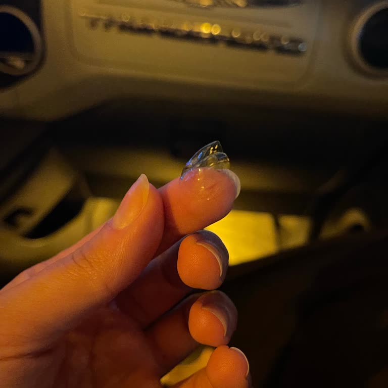 Lütfi Kırdar Şehir Hastanesi Gözümdeki Lensin Tespit Edilememesi Nedeniyle Yaşadığım Mağduriyet!