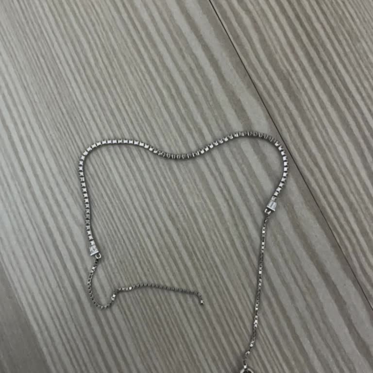 So Chic Bileklik Kullanım Sırasında Kendiliğinden Koptu, Üretim Hatası Şüphesi Ve Güven Kaybı