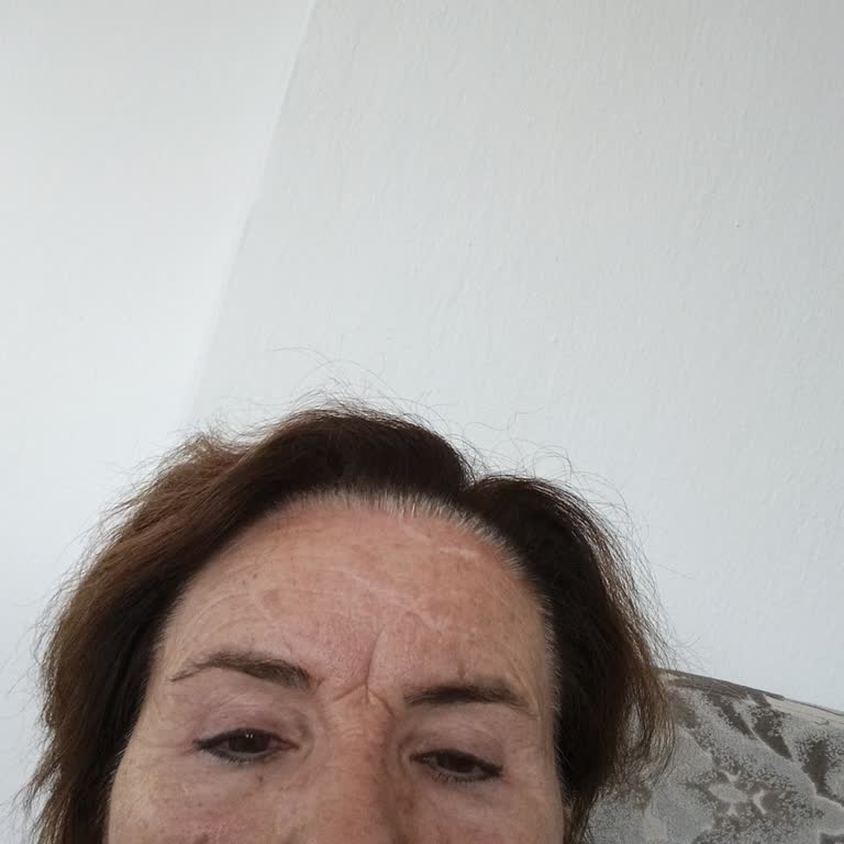 Suit Güzellik Merkezleri Kullandığım Cilt Bakım Ürünleri Cildimi Olumsuz Etkiledi