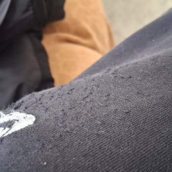 Zara Montun Cırt Bantları Giysilerimi Ve Aracımı Zarar Verdi