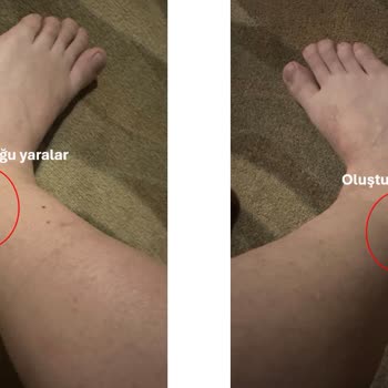 Kısa Süreli Kullanımda Yaralanmaya Sebep Olan Botun İadesi Kabul Edilmedi