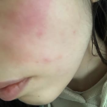 Açık Ve Dökülmüş Gelen Tonik Cildimde Yanma Yaptı, İade Talebim Reddedildi