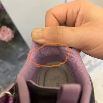 Çocuğumun Sağlığını Tehlikeye Atan Ayakkabıya Ret Ve İlgisiz İnceleme Süreci