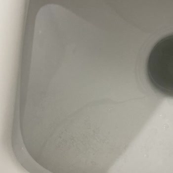 Yeni Alınan Klozetlerde Kararma Ve Çözüm Eksikliği