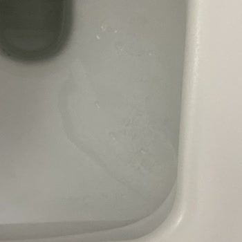 Yeni Alınan Klozetlerde Kararma Ve Çözüm Eksikliği