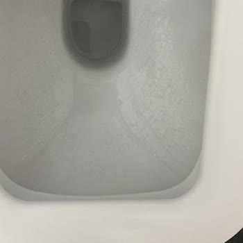 Yeni Alınan Klozetlerde Kararma Ve Çözüm Eksikliği