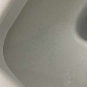 Yeni Alınan Klozetlerde Kararma Ve Çözüm Eksikliği