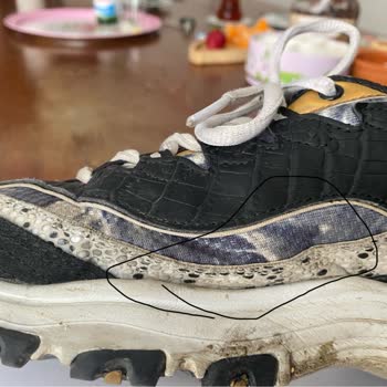 Kısa Sürede Deforme Olan Ayakkabıma 'Kullanıcı Hatası' Yanıtı: Mağduriyetimin Giderilmesini İstiyorum