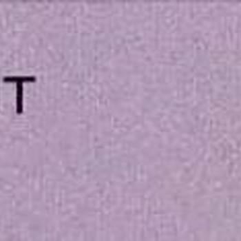Zara Onayım Dışında Yapılan Yüksek Tutarlı İşlem İçin Acil İnceleme ve İade Talebi