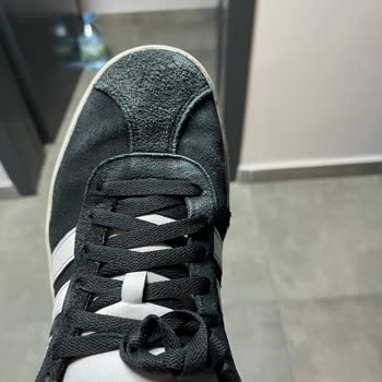 Kısa Sürede Deforme Olan Adidas Ayakkabı İçin İade Talebim Reddedildi