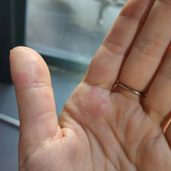 Beaulis Lip Gloss Ambalaj Sorunu: Sürekli Akıyor, Mağduriyet Yaşadım