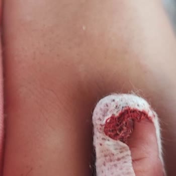 Heroes Oyun Hamuru Kızımın Elini Kesti