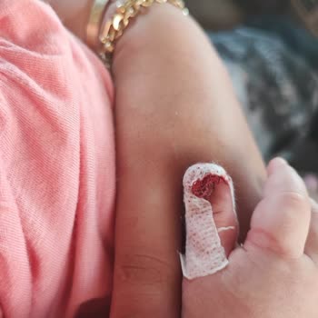 Heroes Oyun Hamuru Kızımın Elini Kesti