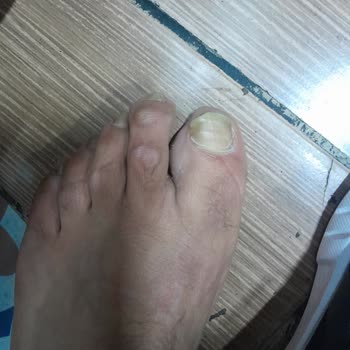 Aldığım Reebok Ayakkabı Ayağımı Rahatsız Etti, Mağaza Değişim Talebimi Reddetti