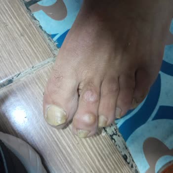 Aldığım Reebok Ayakkabı Ayağımı Rahatsız Etti, Mağaza Değişim Talebimi Reddetti