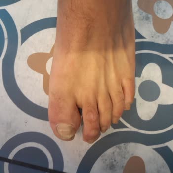 Aldığım Reebok Ayakkabı Ayağımı Rahatsız Etti, Mağaza Değişim Talebimi Reddetti