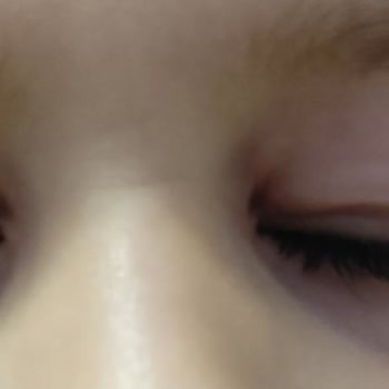 Bozuk Çikolata Nedeniyle Çocuğum Hastanelik Oldu, Sorumluların Araştırılmasını Ve Zararımızın Karşılanmasını İstiyorum