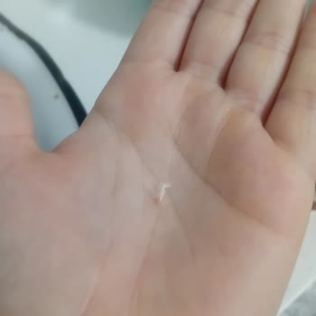 Lezita Sucuktan Tüy Çıktı