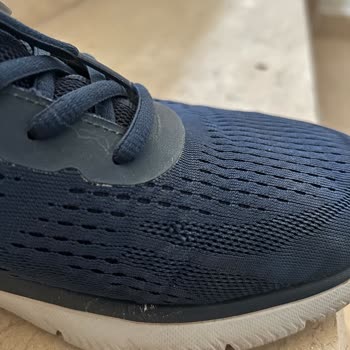 Kısa Sürede Deforme Olan Ayakkabı Ve Yetersiz Müşteri Desteği