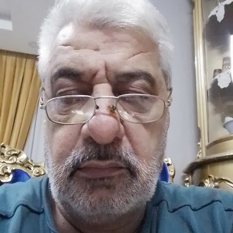 Kimlik Doğrulama Engeli Ve Yetersiz Canlı Destek Nedeniyle Mağduriyet