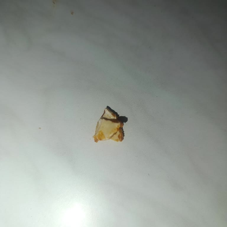 Kuruyemiş Paketinden Çıkan Deniz Kabuğu Endişesi